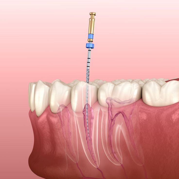 conservative dentistry and endodontics