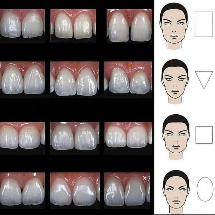 prosthodontics