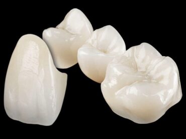 Zirconia crowns