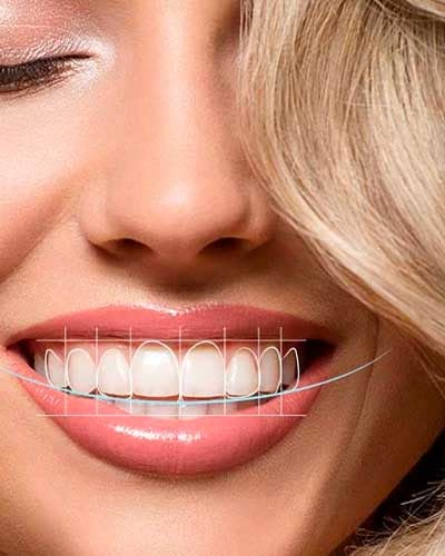 wisdom tooth removal